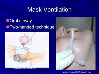 Mask VentilationMask Ventilation
Oral airwayOral airway
Two-handed techniqueTwo-handed technique
www.aic.cuhk.edu.hk
www.haworth21.karoo.net
 