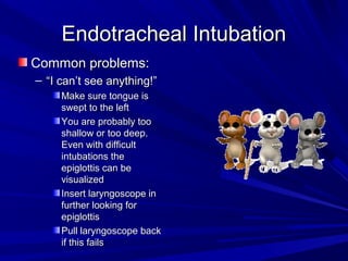 Endotracheal IntubationEndotracheal Intubation
Common problems:Common problems:
– ““I can’t see anything!”I can’t see anything!”
Make sure tongue isMake sure tongue is
swept to the leftswept to the left
You are probably tooYou are probably too
shallow or too deep.shallow or too deep.
Even with difficultEven with difficult
intubations theintubations the
epiglottis can beepiglottis can be
visualizedvisualized
Insert laryngoscope inInsert laryngoscope in
further looking forfurther looking for
epiglottisepiglottis
Pull laryngoscope backPull laryngoscope back
if this failsif this fails
 