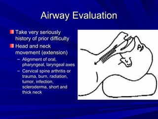 Airway EvaluationAirway Evaluation
Take very seriouslyTake very seriously
history of prior difficultyhistory of prior difficulty
Head and neckHead and neck
movement (extension)movement (extension)
– Alignment of oral,Alignment of oral,
pharyngeal, laryngeal axespharyngeal, laryngeal axes
– Cervical spine arthritis orCervical spine arthritis or
trauma, burn, radiation,trauma, burn, radiation,
tumor, infection,tumor, infection,
scleroderma, short andscleroderma, short and
thick neckthick neck
 