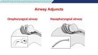 Comprehensive Airway and Breathing Management in Emergency Care | PPTX