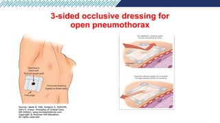 Comprehensive Airway and Breathing Management in Emergency Care | PPTX