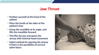 Comprehensive Airway and Breathing Management in Emergency Care | PPTX