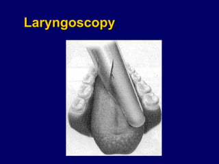 Laryngoscopy 