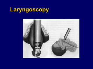 Laryngoscopy 