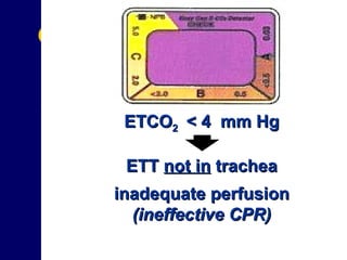 Colorimetric Capnometry ETCO 2  < 4  mm Hg ETT  not in  trachea inadequate perfusion (ineffective CPR) 
