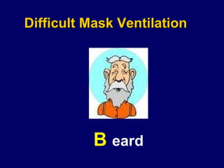 Difficult Mask Ventilation B  eard 