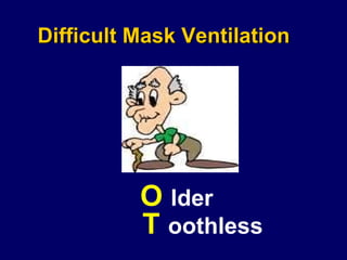 Difficult Mask Ventilation O  lder T  oothless 