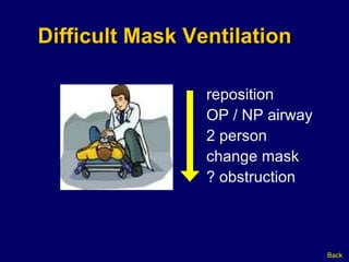 Difficult Mask Ventilation reposition OP / NP airway 2 person  change mask ? obstruction Back 