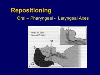 Repositioning Oral – Pharyngeal -  Laryngeal Axes 