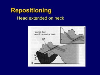Repositioning Head extended on neck 