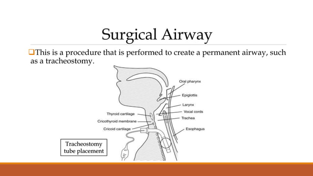 Airway Management and Intubation.pptx