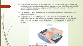 Airway Management [Autosaved].pdf