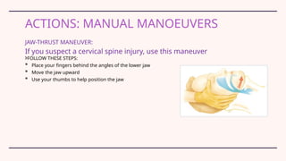 Airway Management Emergency department presentation .pptx
