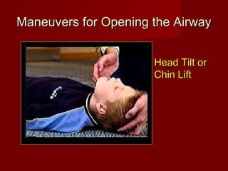 Maneuvers for Opening the AirwayManeuvers for Opening the Airway
Head Tilt orHead Tilt or
Chin LiftChin Lift
 