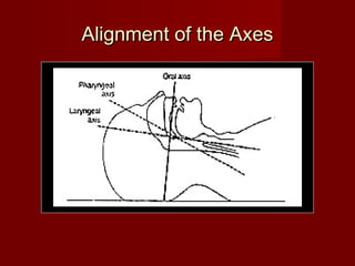 Alignment of the AxesAlignment of the Axes
 