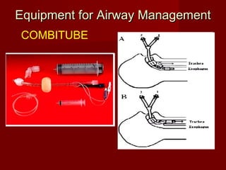 Equipment for Airway ManagementEquipment for Airway Management
COMBITUBE
 