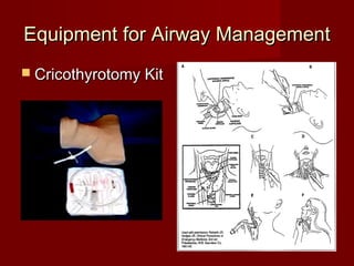 Equipment for Airway ManagementEquipment for Airway Management
 Cricothyrotomy KitCricothyrotomy Kit
 