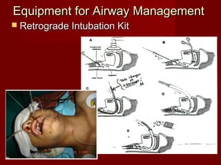 Equipment for Airway ManagementEquipment for Airway Management
 Retrograde Intubation KitRetrograde Intubation Kit
 