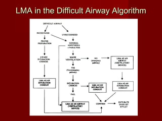 LMA in the Difficult Airway AlgorithmLMA in the Difficult Airway Algorithm
 