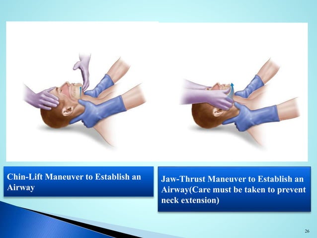 Airway management in trauma victims | PPTX