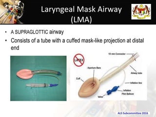 Airway management NCORT.pptx.upload presentation | PPTX