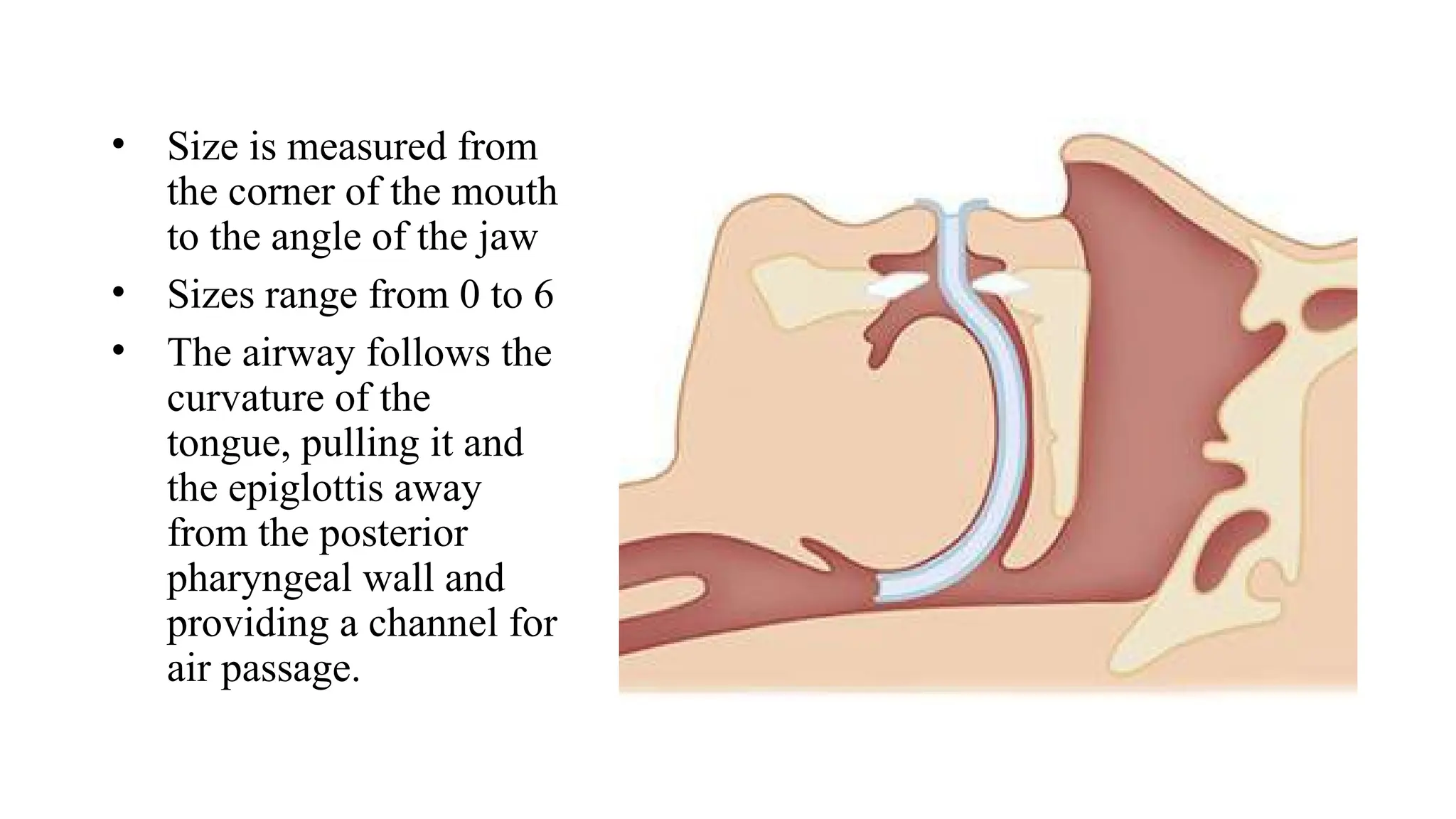 BASIC AIRWAY MANAGEMENT FOR ANAESTHESIOLOGISTS.pptx