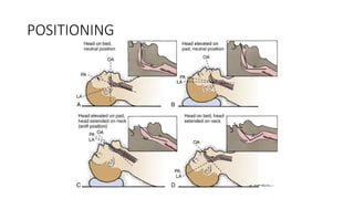 BASIC AIRWAY MANAGEMENT FOR ANAESTHESIOLOGISTS.pptx