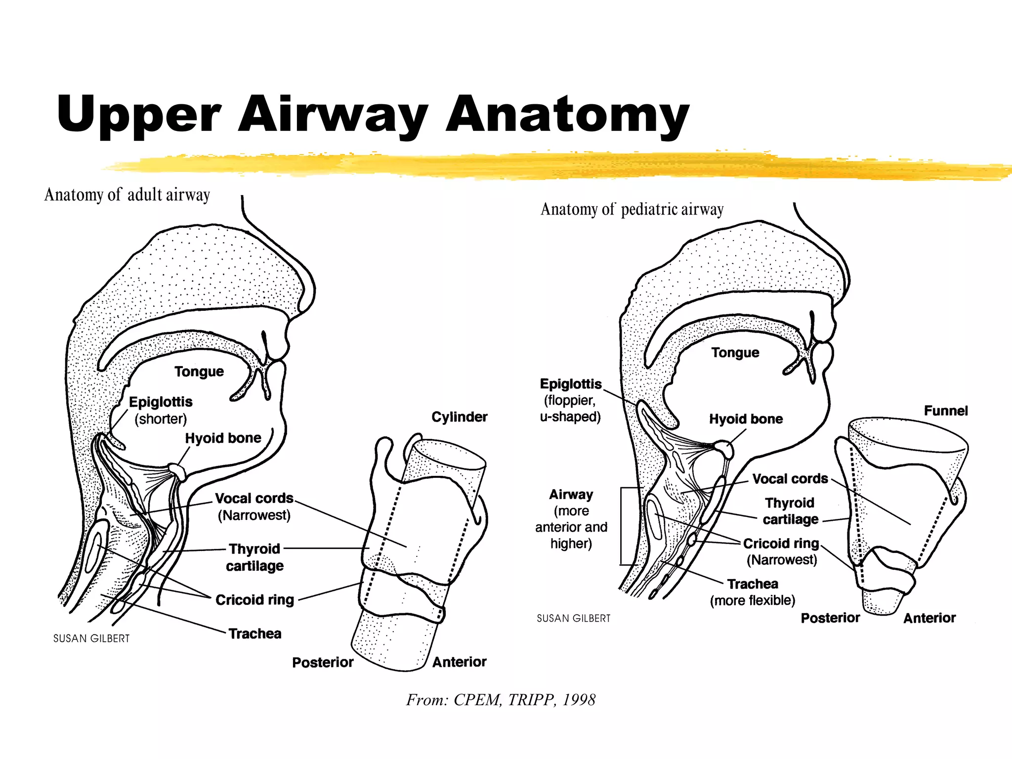 Upper Airway Anatomy From: CPEM, TRIPP, 1998 