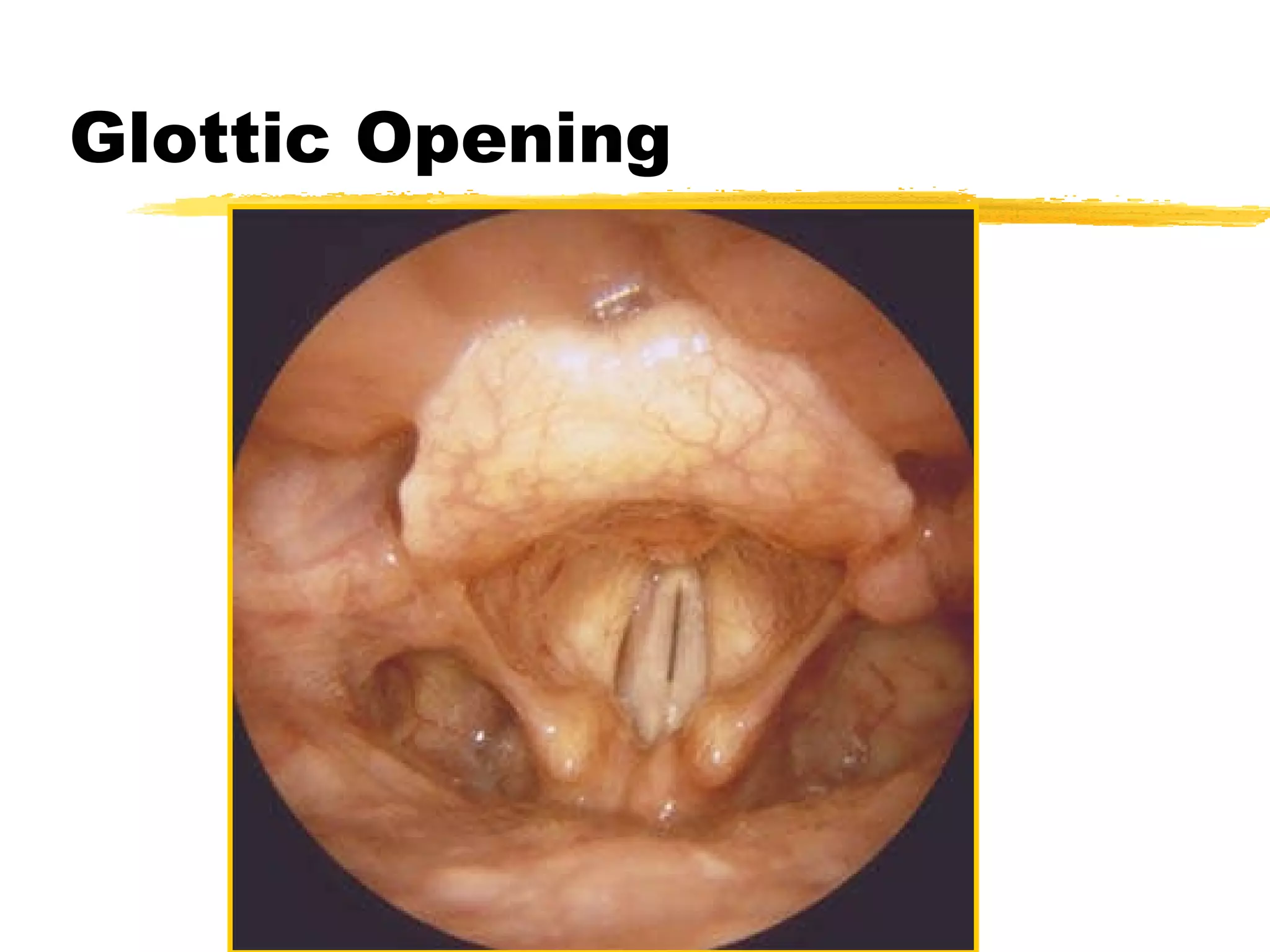 Glottic Opening 