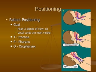 Positioning Patient Positioning Goal Align 3 planes of view, so  Vocal cords are most visible T - trachea P - Pharynx O - Oropharynx 