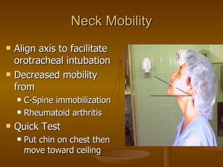Neck Mobility Align axis to facilitate orotracheal intubation Decreased mobility from C-Spine immobilization Rheumatoid arthritis Quick Test Put chin on chest then move toward ceiling 