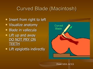 Curved Blade (Macintosh) Insert from right to left Visualize anatomy  Blade in vallecula Lift up and away  DO NOT PRY ON TEETH Lift epiglottis indirectly From AHA ACLS 