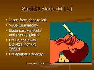 Straight Blade (Miller) Insert from right to left Visualize anatomy Blade past vallecula and over epiglottis Lift up and away  DO NOT PRY ON TEETH   Lift epiglottis directly From AHA ACLS 