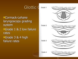 Glottic Opening Cormack-Lehane laryngoscopy grading system  Grade 1 & 2 low failure rates Grade 3 & 4 high failure rates 