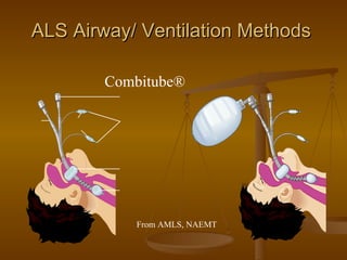 ALS Airway/ Ventilation Methods Combitube® From AMLS, NAEMT 