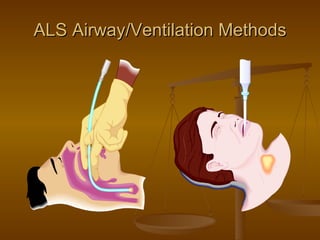 ALS Airway/Ventilation Methods 