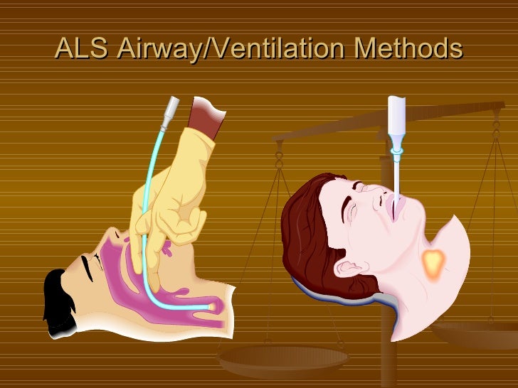 Airway management part 2