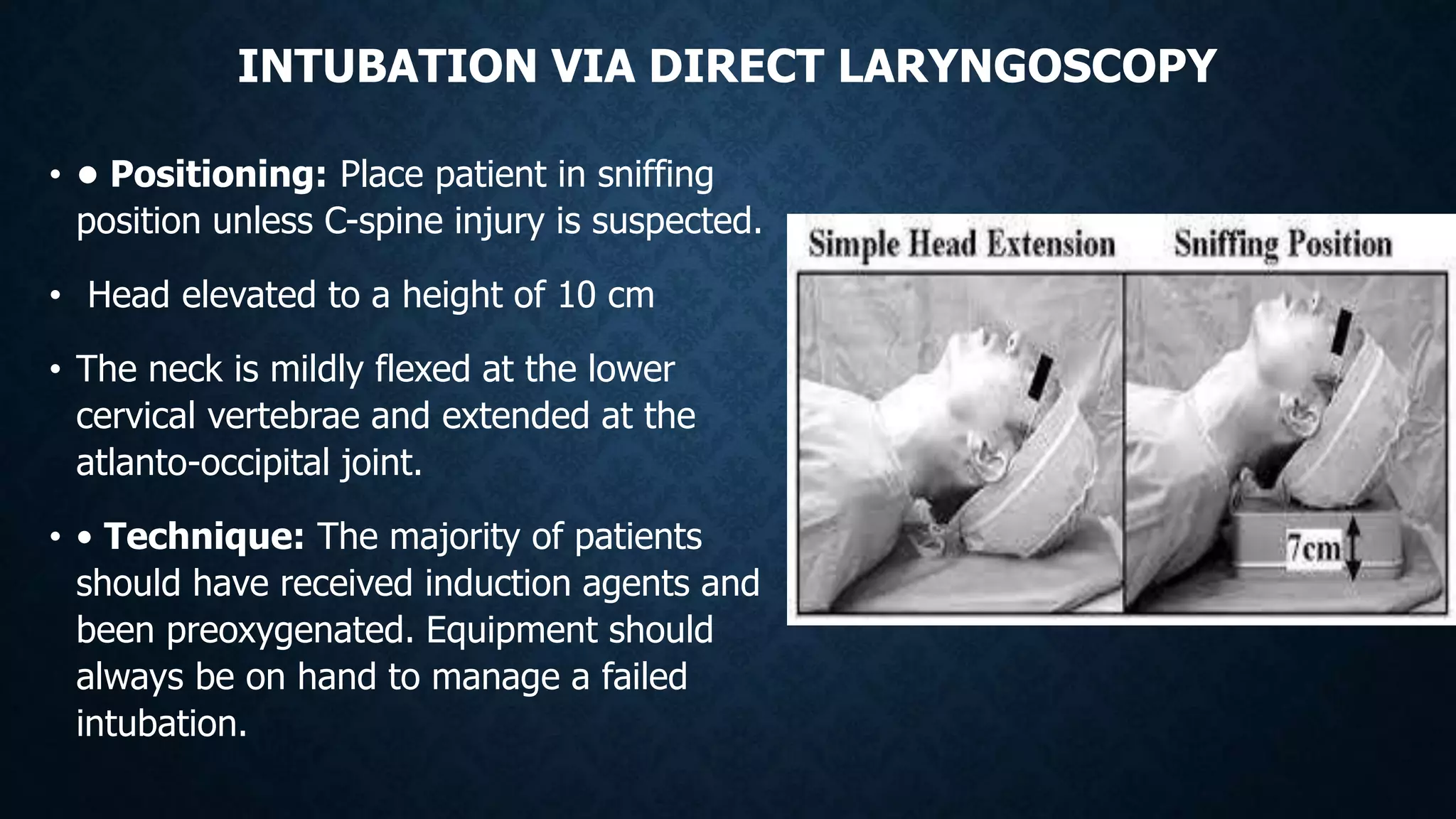 INTUBATION VIA DIRECT LARYNGOSCOPY
• • Positioning: Place patient in sniffing
position unless C-spine injury is suspected.
• Head elevated to a height of 10 cm
• The neck is mildly flexed at the lower
cervical vertebrae and extended at the
atlanto-occipital joint.
• • Technique: The majority of patients
should have received induction agents and
been preoxygenated. Equipment should
always be on hand to manage a failed
intubation.
 