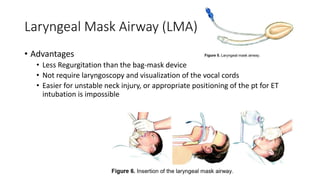 Laryngeal Mask Airway (LMA)
• Advantages
• Less Regurgitation than the bag-mask device
• Not require laryngoscopy and visualization of the vocal cords
• Easier for unstable neck injury, or appropriate positioning of the pt for ET
intubation is impossible
 