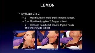 airway_managment emergency intubation and .pptx