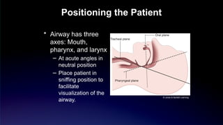 airway_managment emergency intubation and .pptx