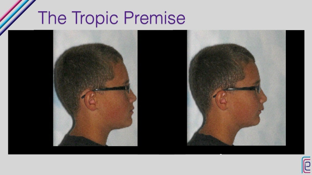 Airway Miniresidency Intro to Airway Orthodontics