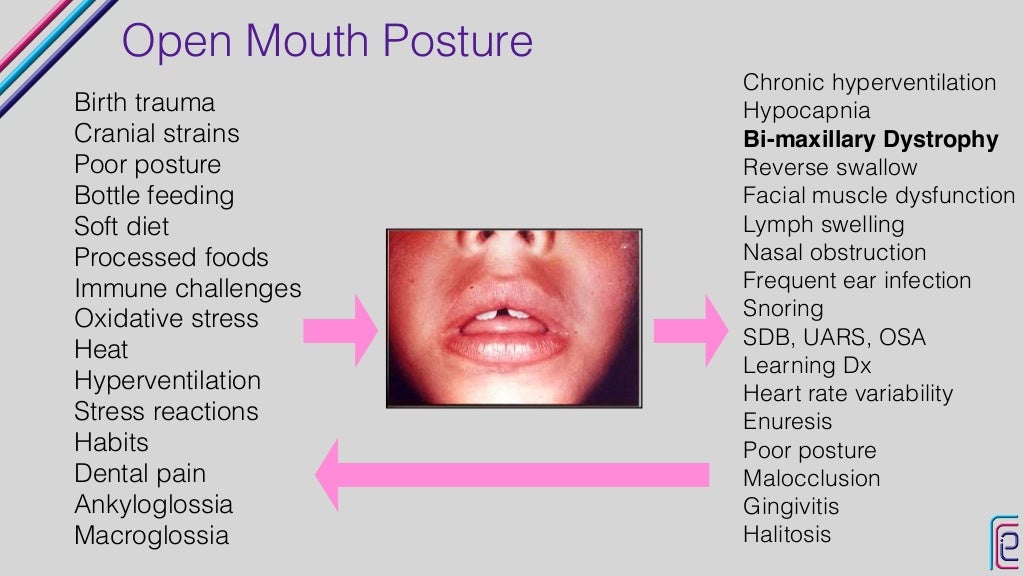 Airway Miniresidency Intro to Airway Orthodontics