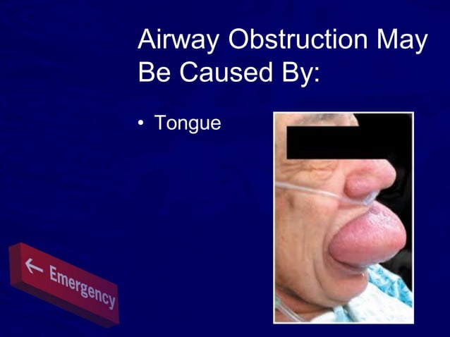 All Of The Following Can Result In Airway Obstructions Except Airway obstruction1 | PPT
