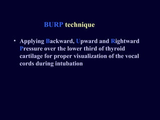 Airway Management | PPT