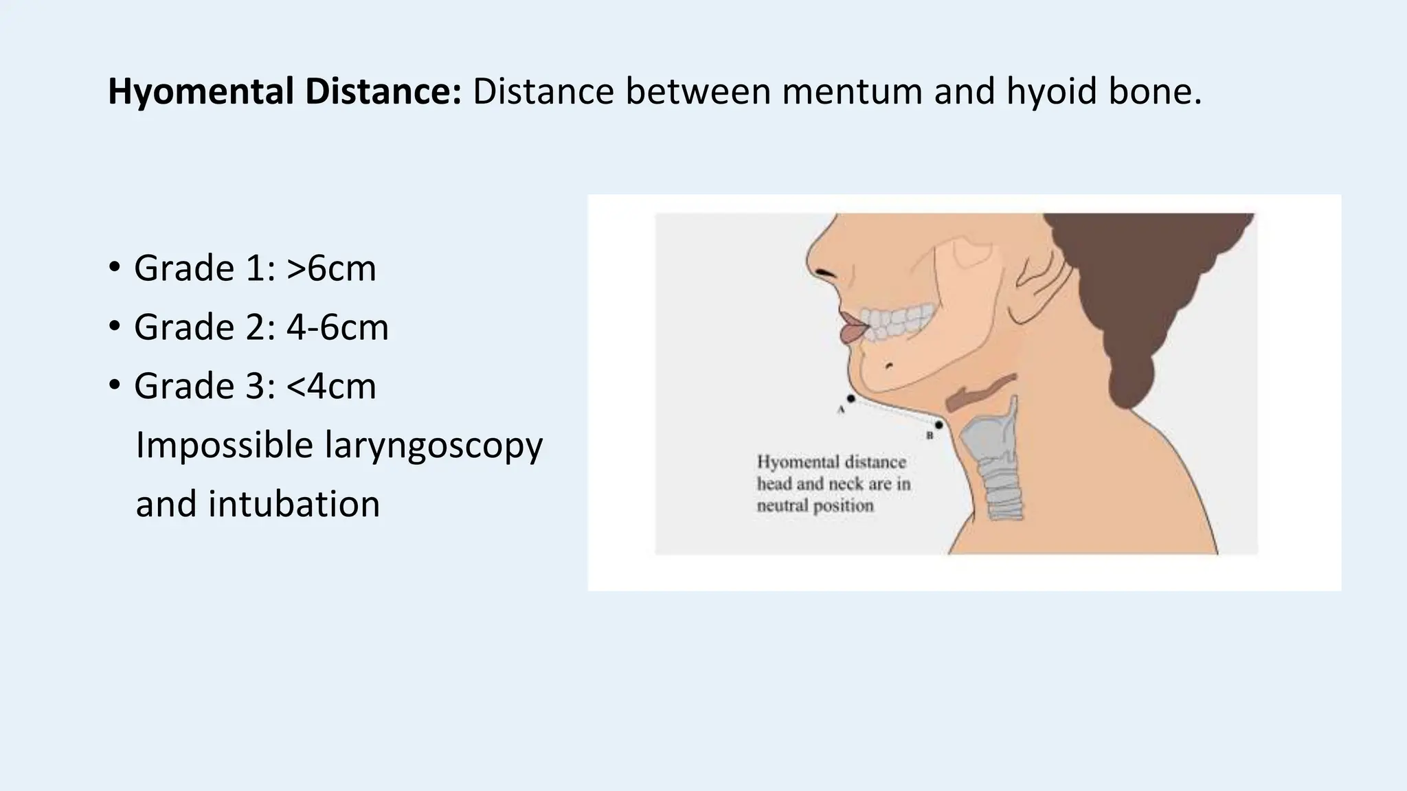 Airway assessment and difficult airway anaesthesia | PPTX