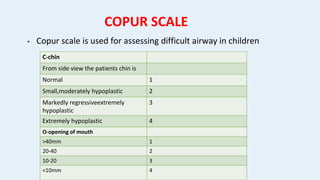 Airway assessment and difficult airway anaesthesia | PPTX
