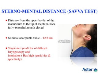 • Distance from the upper border of the
manubrium to the tip of mentum, neck
fully extended, mouth closed  
• Minimal acceptable value – 12.5 cm  
• Single best predictor of difﬁcult
laryngoscopy and  
intubation ( Has high sensitivity &
speciﬁcity).  
STERNO-MENTAL DISTANCE (SAVVA TEST)
 