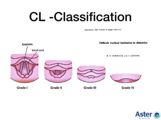 CL -Classiﬁcation
 