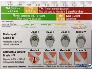 When
putting all
together!!!!
 